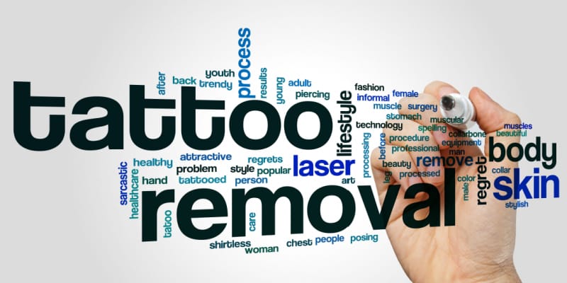 Tattoo removal word cloud concept on a grey background.