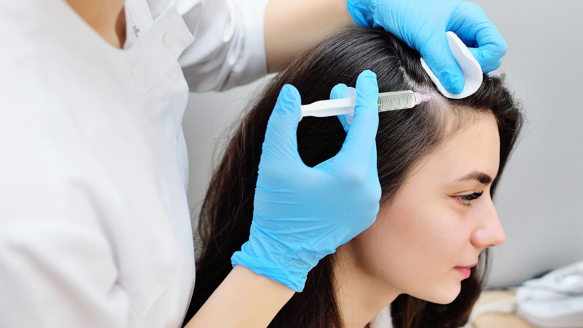 A woman patient is getting an injection on her scalp as part of her PRP hair treatment.